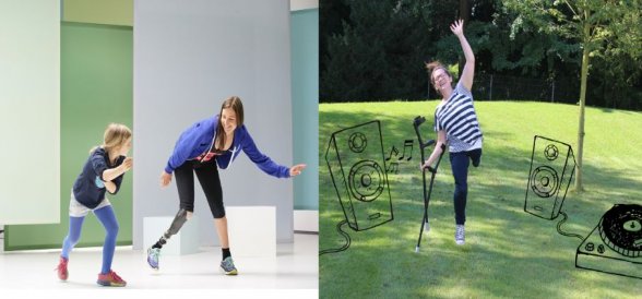 Amputasyon Nedir?  Amputasyon Nedenleri ve Protez Kullanımını Etkileyen Faktörler