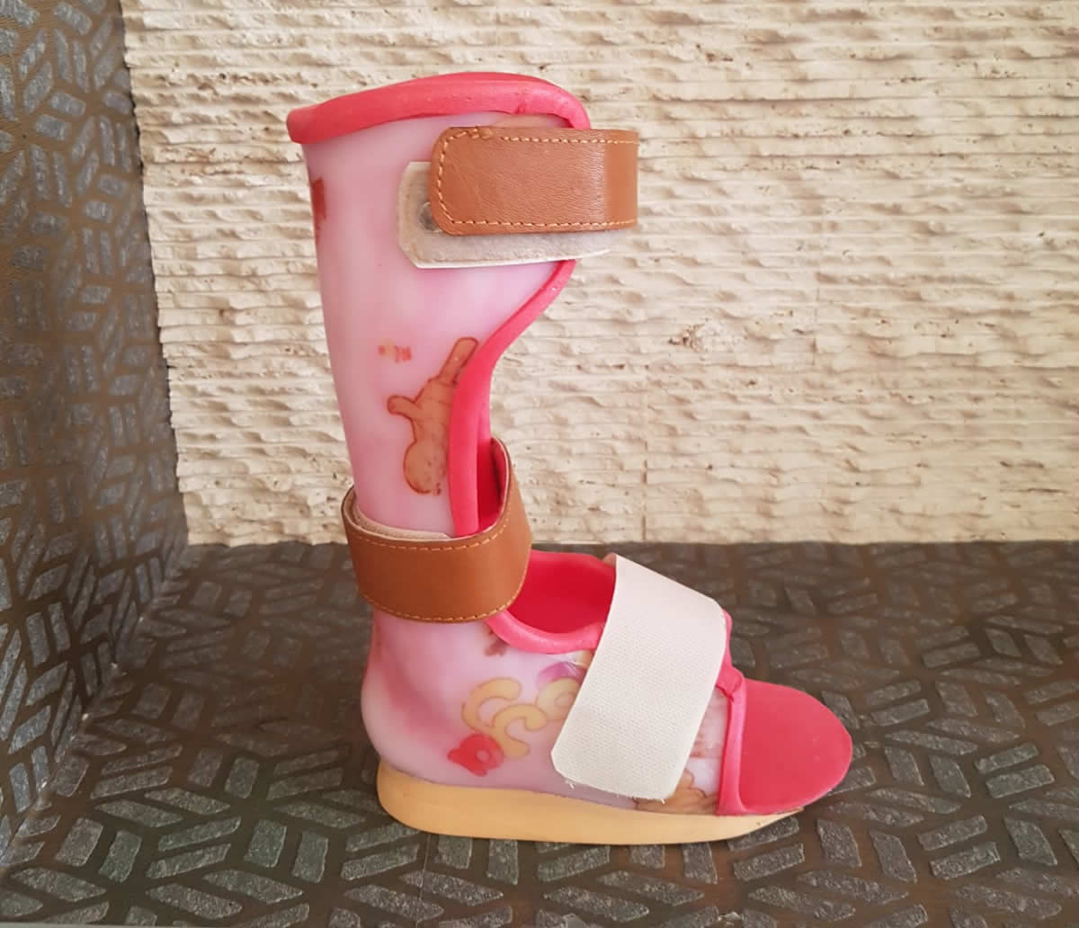 Bacak ve Ayak Ortezleri