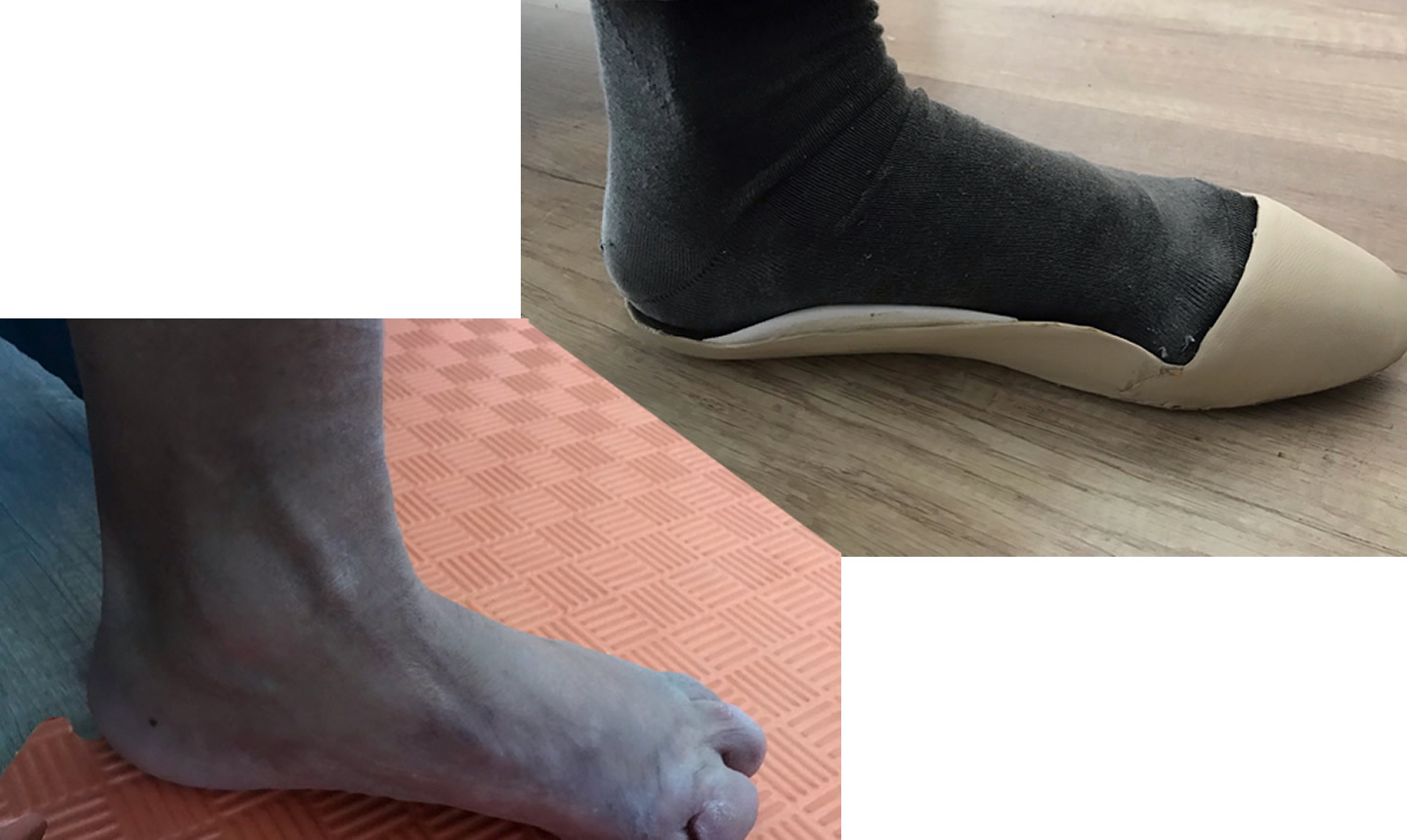 Parsiyel Dolgulu Tabanlık