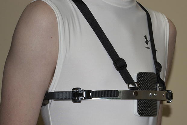 Pektus-Ekskavatum-karinatum-7