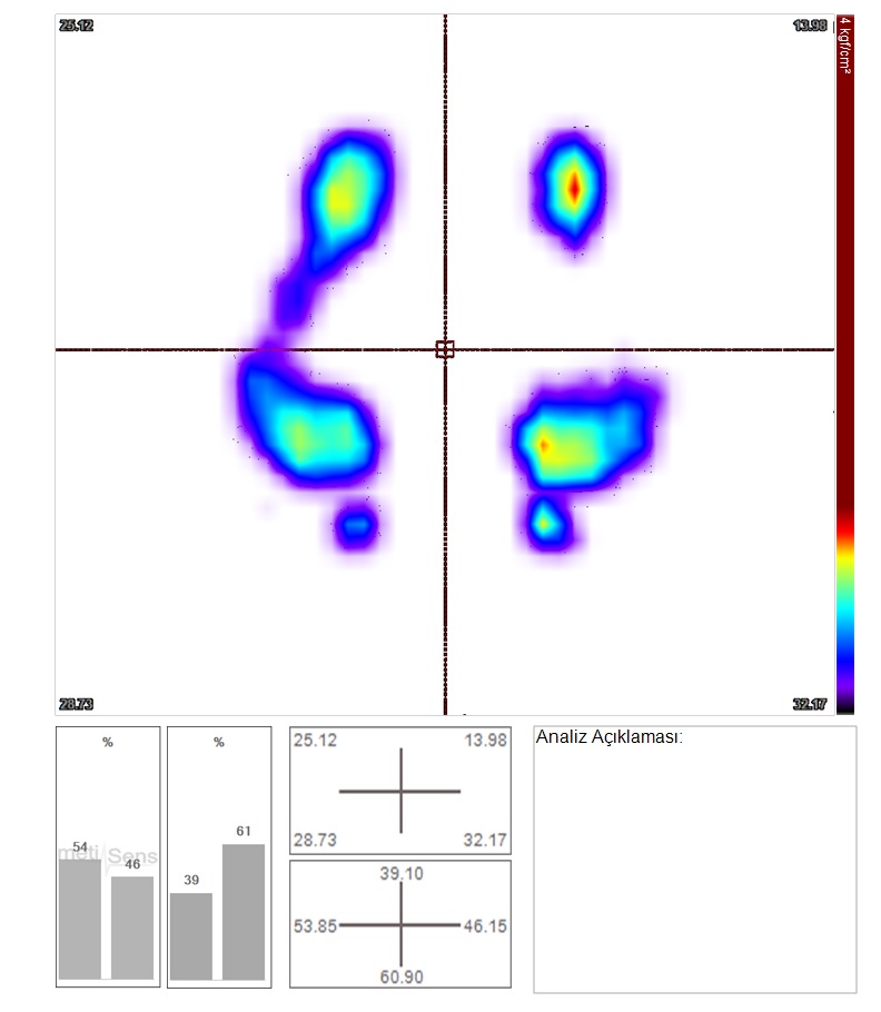 cocuklarda-skolyoz-patolojisi