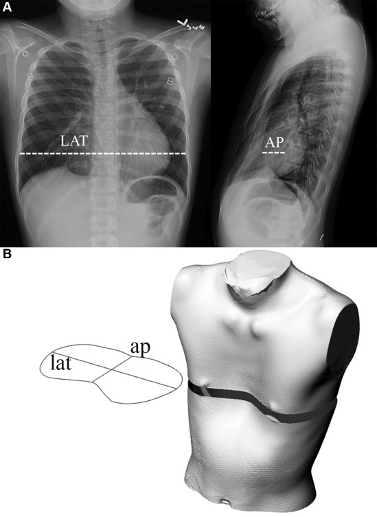 kariyerortopedi-sternum-2