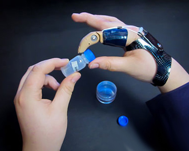 Parsiyel el amputasyonları